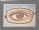 Mayo' s Eye